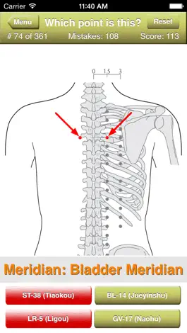 Game screenshot Acupuncture Points Quiz hack