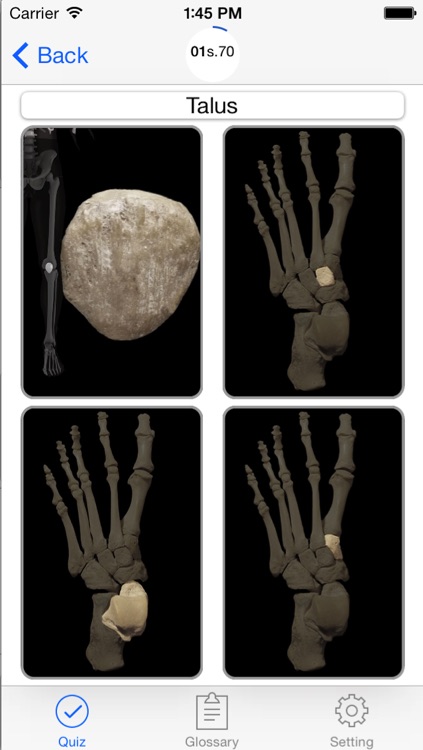 Anatomy, Physiology Quiz and Glossary for iPhone screenshot-3