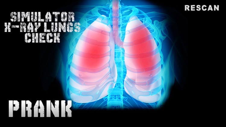 Simulator X-Ray Lungs Check