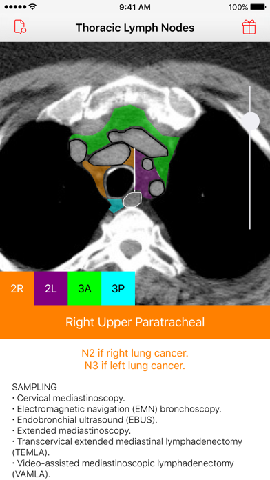 Thoracic Lymph Node Map Screenshot