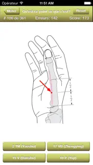 acupuncture points quiz iPhone Captures Décran 4