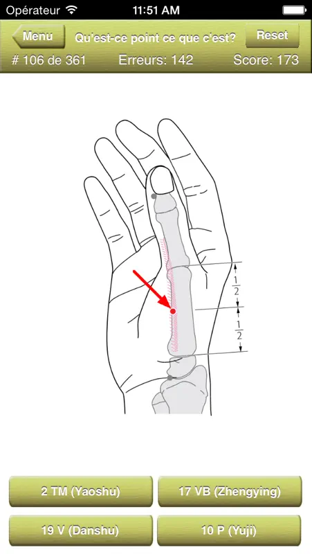 Acupuncture Points Quiz screenshot 4 of 5