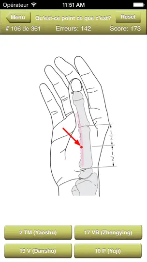 Capture d'écran de Acupuncture Points Quiz sur iPhone 4