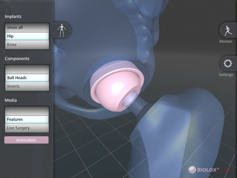 Screenshot #5 pour BIOLOX inside