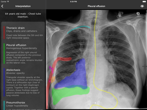 RealWorld Radiologyのおすすめ画像1