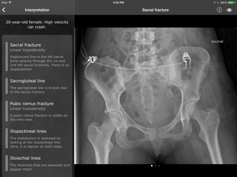 RealWorld Orthopaedics iPad screenshot 2 - Medical app