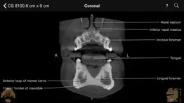 cbct problems & solutions and troubleshooting guide - 2