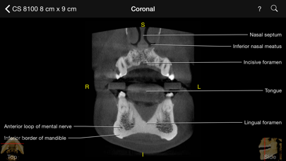 CBCT Screenshot