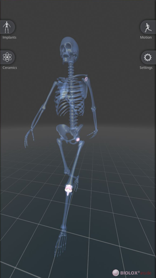 Screenshot #1 pour BIOLOX inside