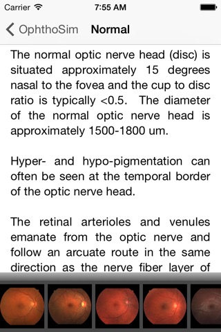 OphthoSim Companion screenshot 2