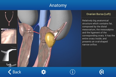 Ovariectomy in Dogs (Free Version) screenshot 2