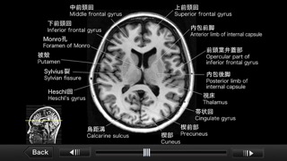 CT・MRI解体新書のおすすめ画像5