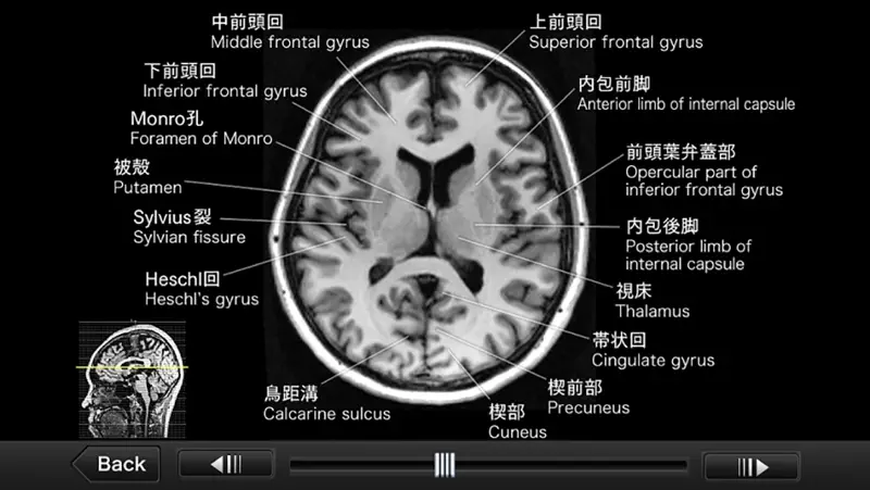 CT・MRI解体新書 screenshot 5 of 5