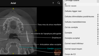 Screenshot #3 pour CBCT