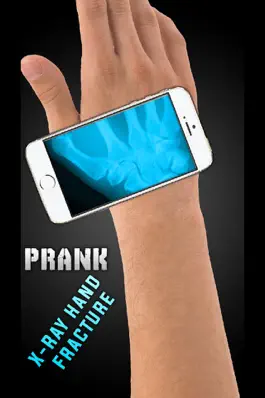 Game screenshot Simulator X-Ray Hand Fracture mod apk