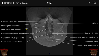Screenshot #1 pour CBCT