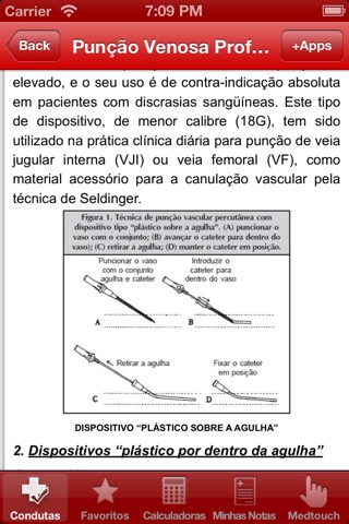 Condutas em Emergência - Pronto-socorro, paramédico, terapia intensiva e plantãoのおすすめ画像3