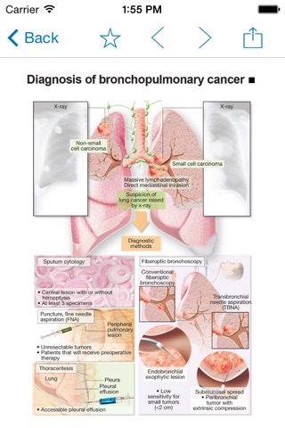 Miniatlas Lung Cancer screenshot 2