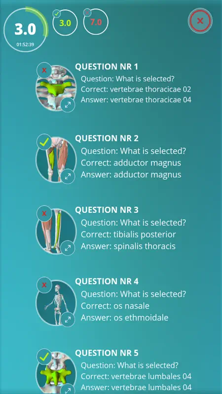Anatomy Quiz - muscles and bones screenshot 4 of 5