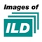 Images of ILD is a novel and unique software tool for training professional skills in interpreting CT scans of Interstitial Lung Disease (ILD) patients