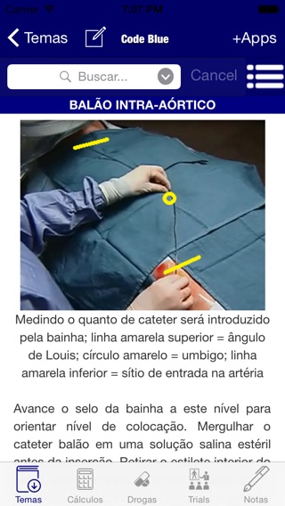 Guia de CTI - Code Blue - Medicina Intensiva, emergência, terapia intensiva, cuidado intensivo, cti, uti, emergenciaのおすすめ画像2