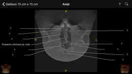 cbct problems & solutions and troubleshooting guide - 3