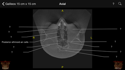 CBCT Screenshot