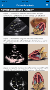 SonoSupport: a clinical emergency medicine and critical care ultrasound reference tool screenshot
