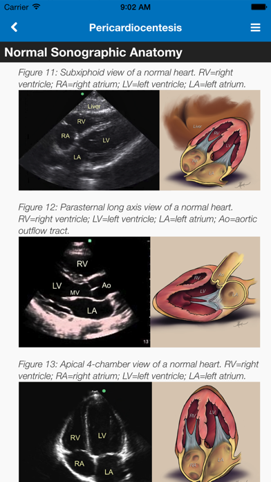 SonoSupport: a clinical emergency medicine and critical care ultrasound reference tool Screenshot