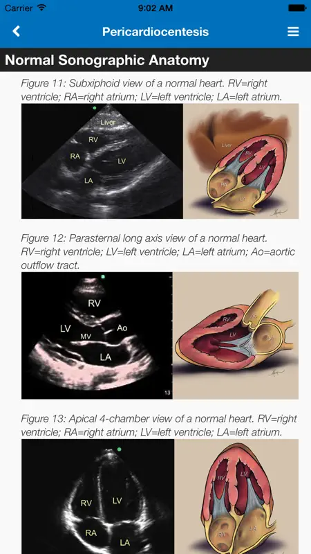 SonoSupport: a clinical emergency medicine and critical care ultrasound reference tool screenshot 2 of 5