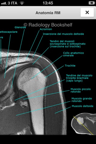 Radiology Bookshelf: Apparato Muscoloscheletrico screenshot 4