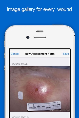 SmartWoundCare screenshot 3