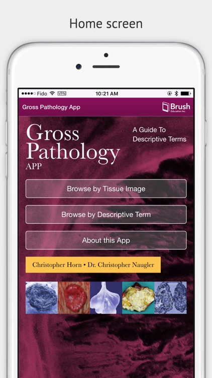 Gross Pathology