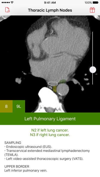Thoracic Lymph Node Map Screenshot