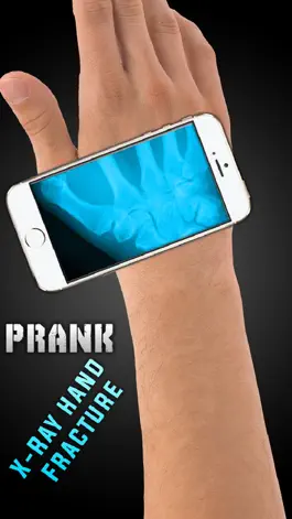 Game screenshot Симулятор Рентген Руки Перелом mod apk