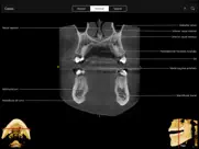 cbct ipad resimleri 3