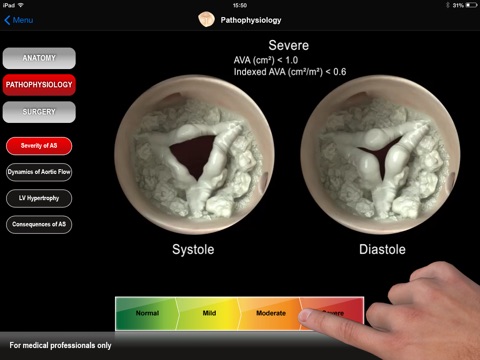 HEART MASTER Aortic Stenosis screenshot 4