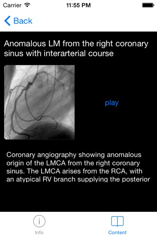 CARDIO3® Interventional Atlas screenshot 2