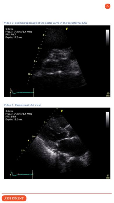 Screenshot #3 pour HeartWeb