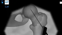 Game screenshot Bonedoc hack