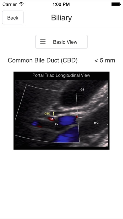 Pocket Emergency Ultrasound