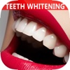 Best Natural Way To Whiten Teeth - Home Remedies Guide & Tips For Beginners, Save Money!