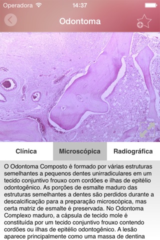 Oral Lesions screenshot 3