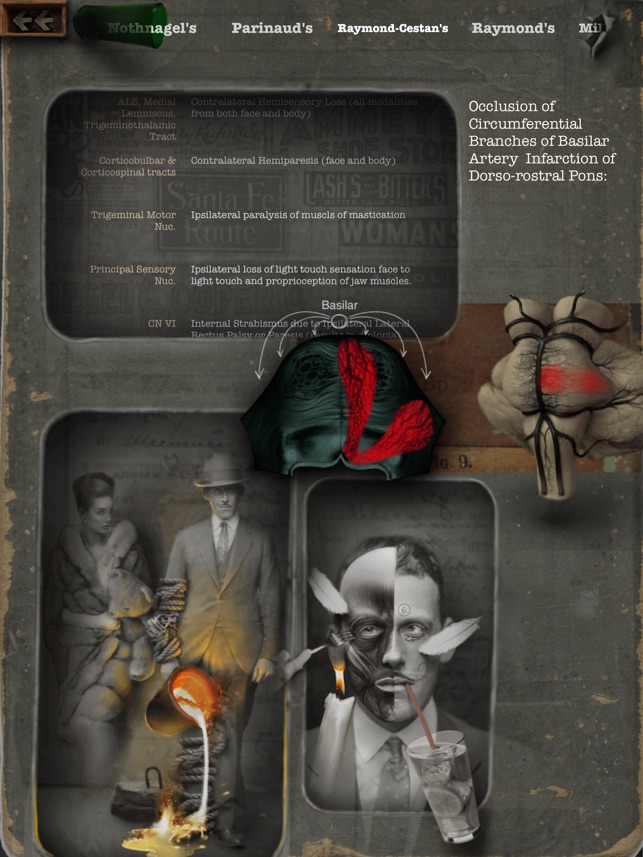 Brainstem101 - Neuroanatomy of the Human Brainstem(圖3)-速報App