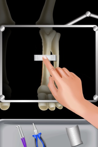 Kids X-ray Doctor – Treat crazy little patients in this bone surgery game for kids and give medical care. screenshot 3