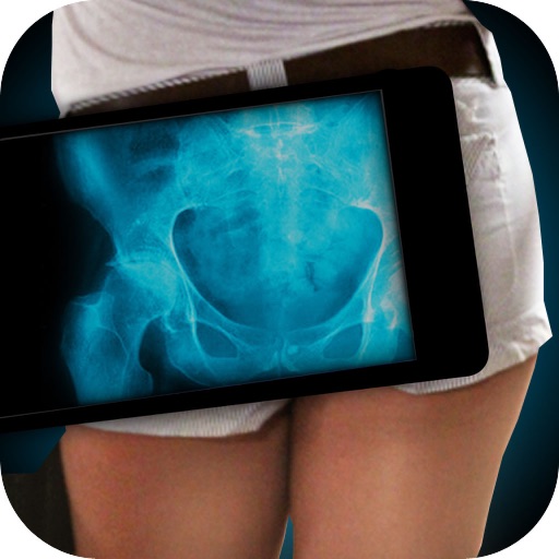 Simulator X-Ray Photo Hip Bone