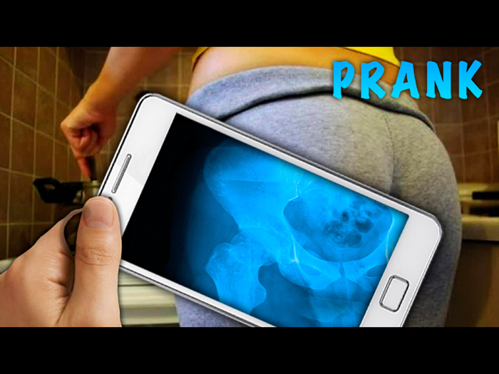 Simulator X-Ray Hip Bone