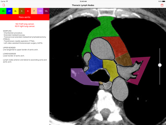 Screenshot #5 pour Thoracic Lymph Node Map