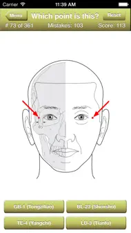 Acupuncture Points Quiz iphone bilder 1