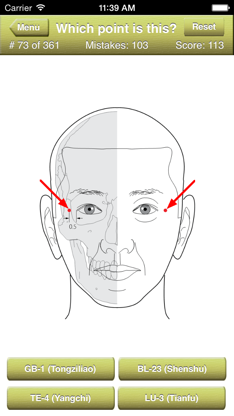 Acupuncture Points Quiz screenshot 2